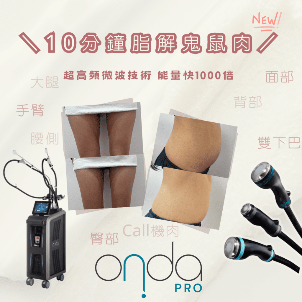 onda pro一叮溶脂效果